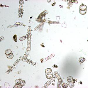 43_melosira_100x.jpg