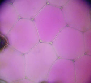 654px-rhoeo_discolor_epidermis.jpg 654px-rhoeo_discolor_epidermis.jpg