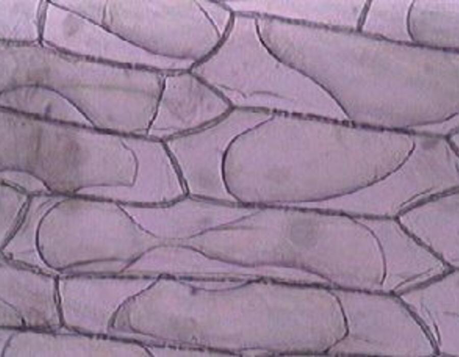 plasmolysis.jpg